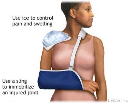 Los Angeles, West Hollywood, Beverly Hills Chiropractor Dr. Nick Campos Shoulder Treatment, Ice